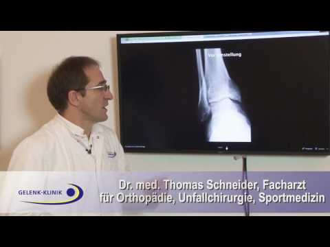 Osteochondrose mit Deformieren Spondylose Kochsalzlösung komprimiert an den Gelenken