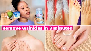 How to Remove Wrinkles & Fine Lines from Hands & Foots in 3 minutes 😱 |