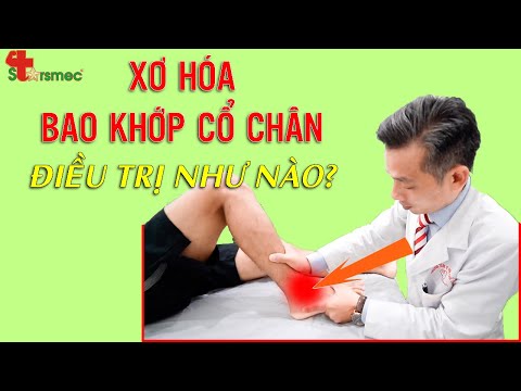 BAO KHỚP CỔ CHÂN BỊ XƠ HÓA - Điều trị như thế nào? | Bác sĩ Thể thao Nguyễn Trọng Thuỷ