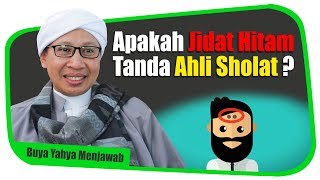 Download lagu Apakah Jidat Hitam Tanda Ahli Sholat? - Buya Yahya Menjawab mp3