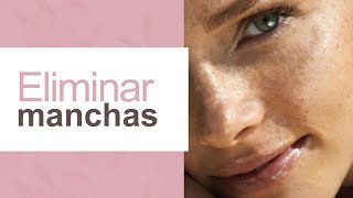 Qué hacer para eliminar las manchas de la piel l Dra. María Clara Mejía