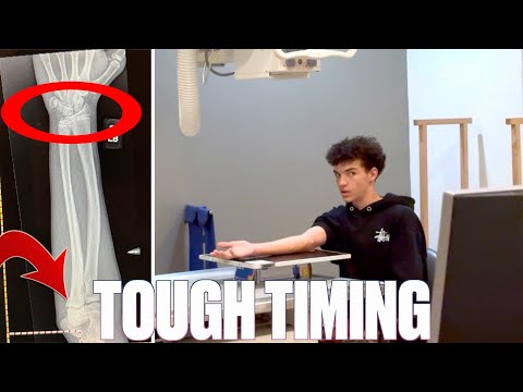 BROKEN ARM BEFORE BASKETBALL TRYOUTS?!