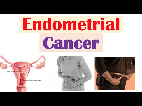 Endometrial Cancer | Risk Factors, Pathogenesis, Signs & Symptoms, Diagnosis, Treatment, Prevention