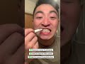 This Teeth Whitening Pen Is A Game Changer Teeth Smile Dentalcare Teethwhiteningreviews