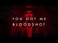 Sam Tinnesz - Bloodshot [Official Lyric Video]