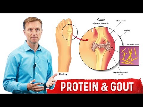 Deeper Causes of Pain Inflammation – Dr Berg