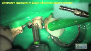 extractor de perno.mov