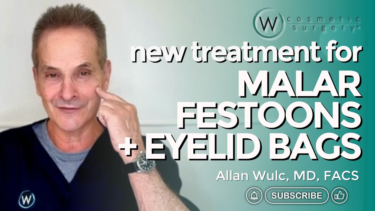 New Treatment for Malar Festoons and Big Eyelid Bags