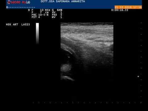 Mouse ginocchio articolare foto congiunta Gonfiore del trattamento congiunto