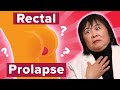 How To Cure Rectal Prolapse