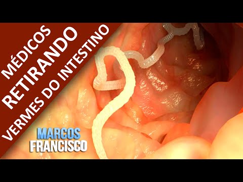 A quello che il parassita in un occhio sogna I farmaci più cari per vermi