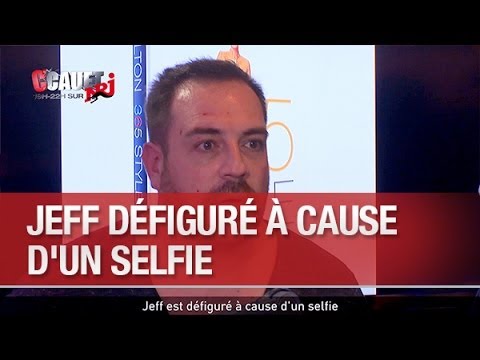 Jeff is disfigured because of a selfie - C’Cauet on NRJ