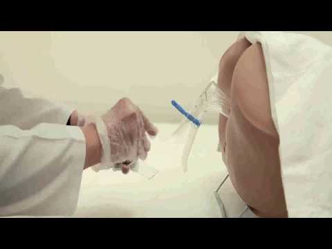 hpv impfung barmer