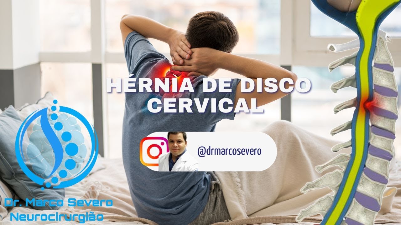 Marco Aurélio Severo Da Silva Versiani-79