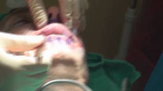 Dr. Philip Young
