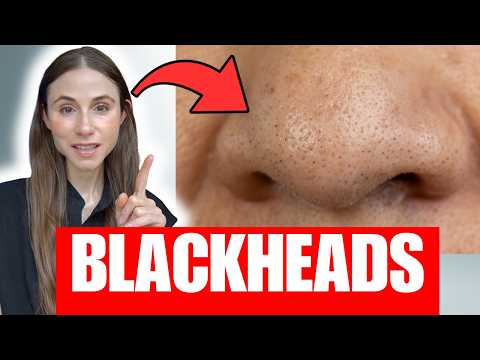 Blackheads on the Nose? Here’s What They Really Are | Derm Explains