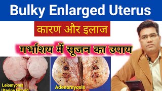 What is Bulky (Enlarged) Uterus - Cause Symptoms and Treatment | गर्भाशय में सूजन का इलाज