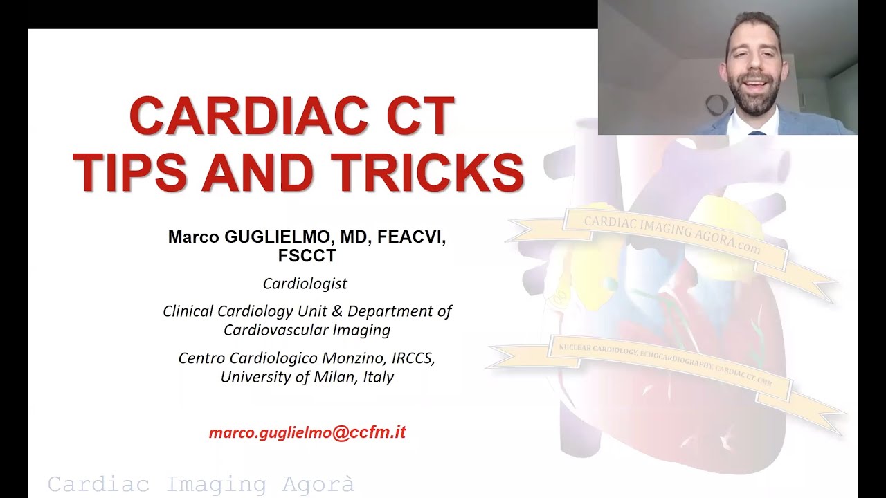 Cardiac CT tips and tricks