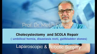Miniaturka - Cholecystectomy & SCOLA Repair. Metin Ertem. MD.FACS.