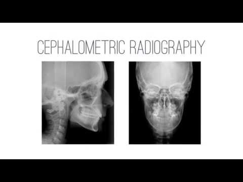 XMIND TRIUM 1 teasing EN