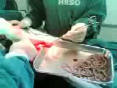 Come dare da vermi a un cucciolo di un Labrador Le dimensioni di vermi in un corpo umano