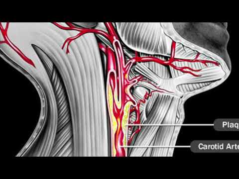 Sinjalet e Fshehura Që Tregojnë se i Keni Enët e Gjakut të Bllokuara