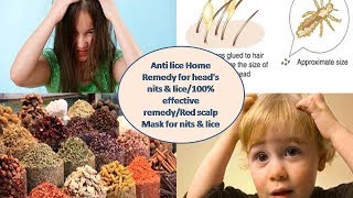 Anti lice Home Remedy for head's nits & lice/100% effective remedy/Red scalp Mask for nits & lice