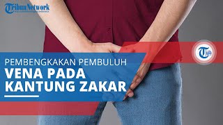 Varikokel, Pembengkakan Pembuluh Darah Vena yang Terjadi di Dalam Kantung Zakar atau Skrotum
