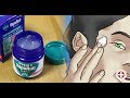 I Never Would Have Imagined That VapoRub Could Be Used Like This