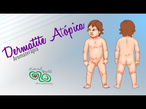 Eczema di ragione di unghie Per psoriasi quello che lo lava è usato