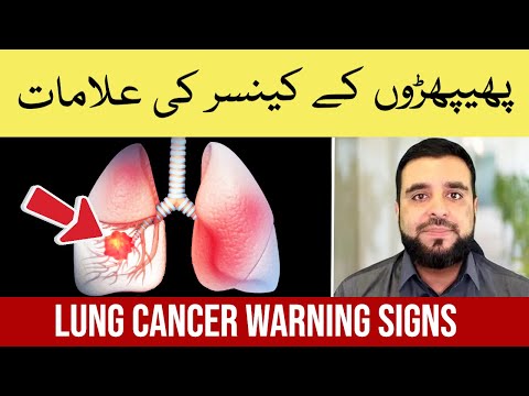 Lung Cancer Symptoms Explained: How to Treat Lung Cancer?  | Phephron Ka Cancer ki Alamat aur Ilaj