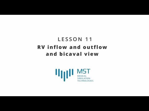 MST Masterclass - Lesson 11 - RV inflow and outflow and bicaval view