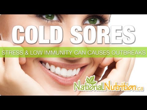 Natural Treatments for Cold Sores From NationalNutrition.ca - National  Nutrition Articles