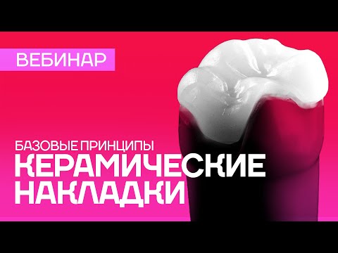 Керамические накладки - базовые принципы. Вебинар