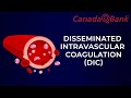 DIC Disseminated Intravascular Coagulation