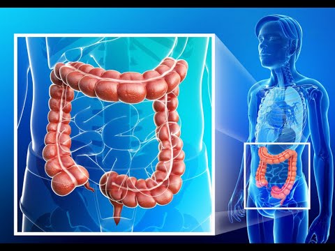 Vermi a sintomi di adulti e rimedi di gente di trattamento Essere umano di ascarid helminth