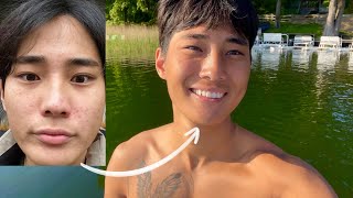 How I removed all my pimples living THIS lifestyle