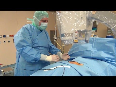 Die Knie Kondylenfraktur Behandlung Rückenschmerzen Behandlung ist ein medizinisches Portal