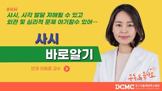 [TBC 닥터리포트] - 사시 바로알기