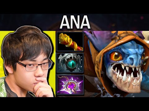 Slark Dota 2 Gameplay Ana with 20 Kills and Skadi