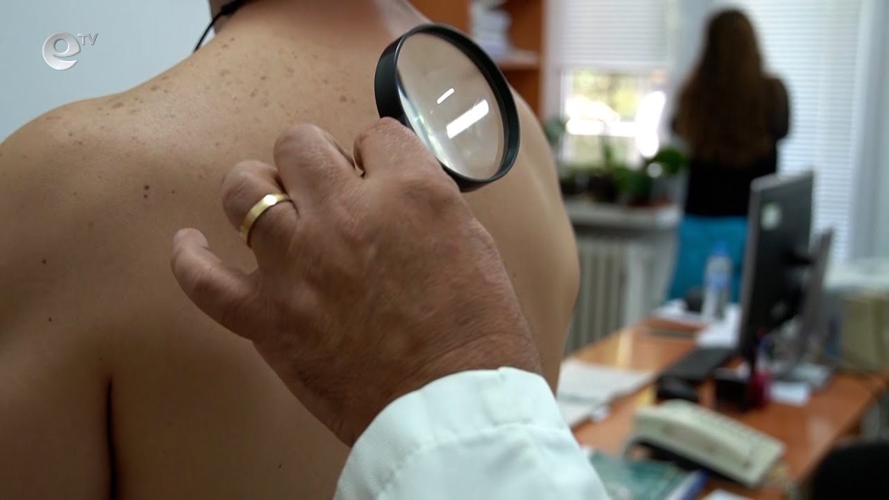 Специалисти отчитат ръст на кожните заболявания, свързват го с климатичните промени