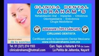 preview picture of video 'Clínica Dental Abraham's'