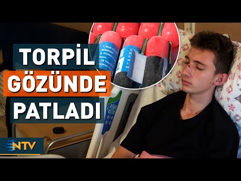 Not a Toy, Practically a Weapon! Firecracker Explodes in the Eye of a 16-Year-Old | NTV