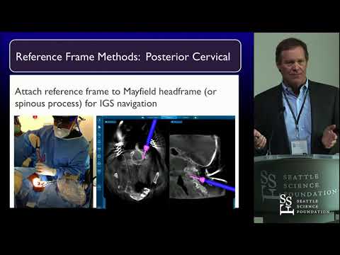 Spine Navigation   J  Patrick Johnson, MD