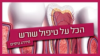 טיפול שורש - שלבים והחלמה