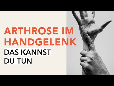 Schmerzen in den Gelenken der Hände und Füße Creme Gelenke effektum