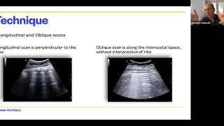 Webinar: How we do it  lung ultrasound for patients with CoViD 19 SARS CoV 2 lung disease