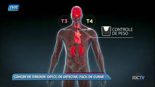Conversando Sobre Câncer: câncer de tireoide é difícil de detectar, mas é fácil de curar