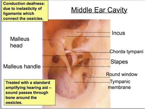 Unit14c Ear Anatomy A&PI Lab
