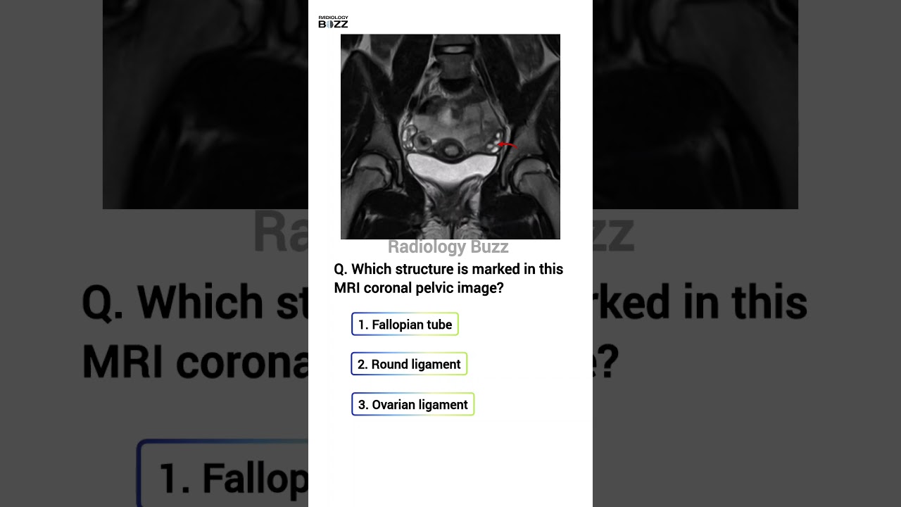 🩺Pelvic MRI Quiz: Can You Identify This Structure?🤔